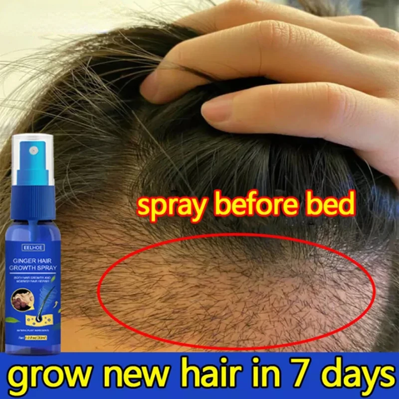 Hair Growth สเปรย์ส่งเสริม Fas - Perfume Zara บทวิจารณ์และราคา