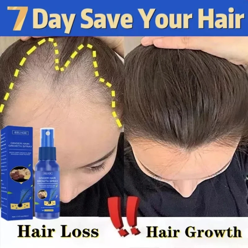 Hair Growth สเปรย์ส่งเสริม Fas - Perfume Zara บทวิจารณ์และราคา