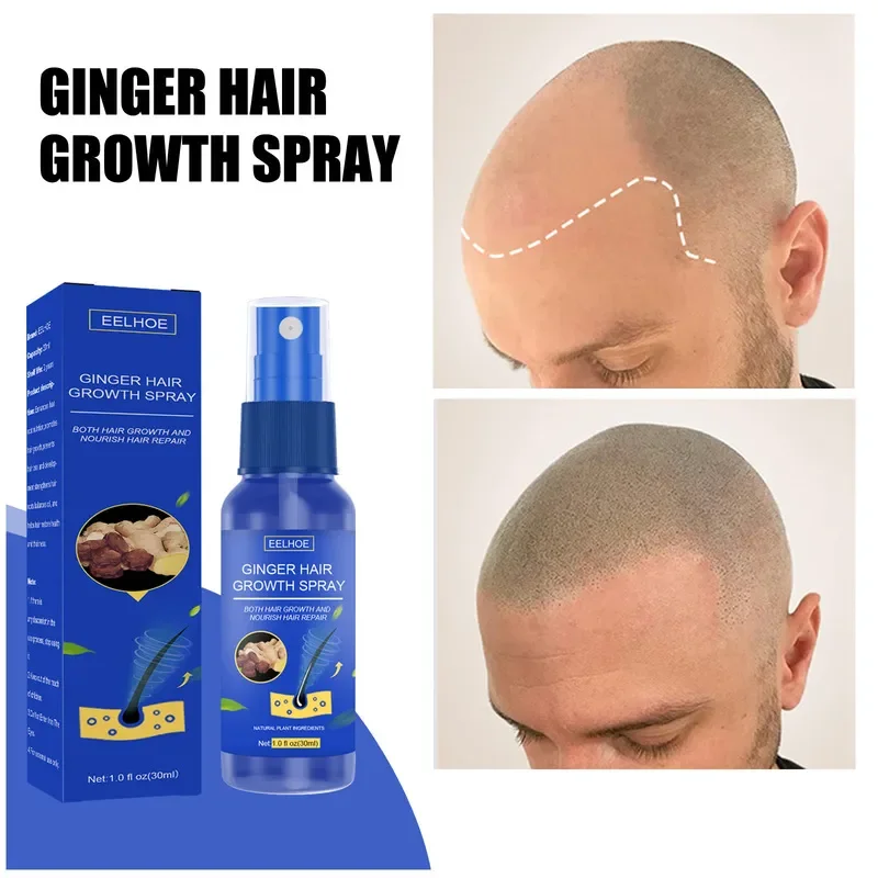 Hair Growth สเปรย์ส่งเสริม Fas - Perfume Zara บทวิจารณ์และราคา